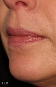 patient 2853 after